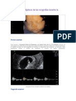 Ecografia Obstetrica