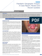 Paediatric Geographic Tongue: A Case Report, Review and Recent Updates