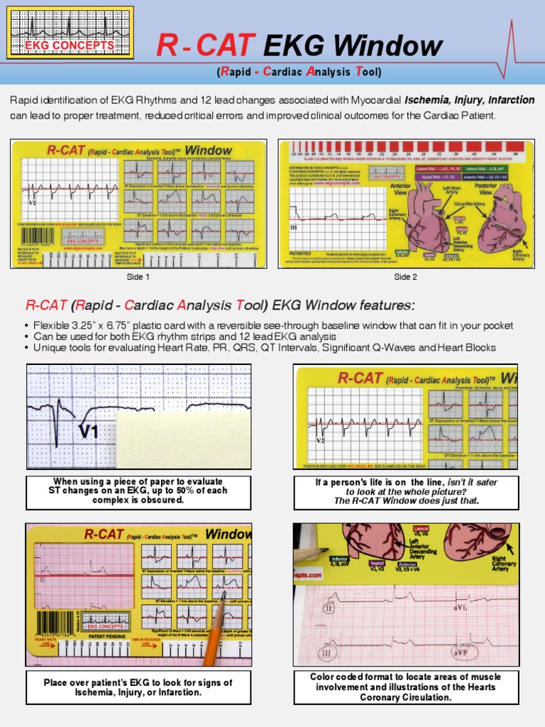 RCAT Window | PDF | Electrocardiography | Heart