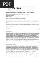 Hiperparatiroidismo Inducido Por Litio e Hipercalcemia