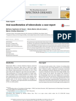 Oral Manifestation Tuberculosis