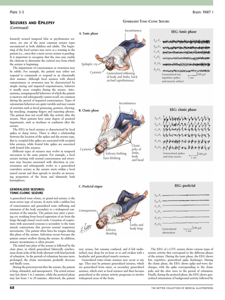 Pages From 1416063870 - Illustrat1-3 | PDF | Epilepsy | Neurological ...