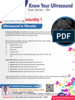 #Ultrasound in #Fibroids