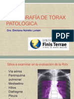 rxtx_patologica.pdf