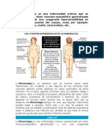 La Fibromialgia