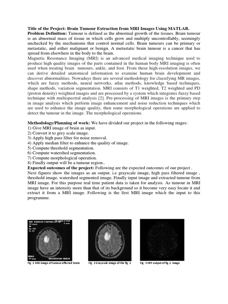 MRI Brain Tumor Extraction Using MATLAB | PDF | Brain Tumor | Magnetic ...