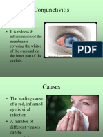 153739924-Conjunctivitis.ppsx