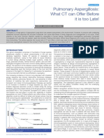 Pulmonary Aspergillosis: What CT Can Offer Before It Is Too Late!