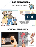 Condón, método anticonceptivo temporal