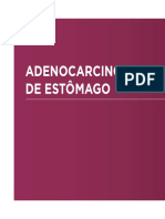 Adenocarcinoma estômago