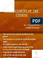 Displacement of The Uterus