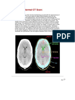 CT Scan