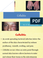 Cellulitis: by Mr. M. Shivananda Reddy