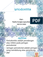 Periodontitis New