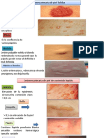 Lesiones Primaria de Piel Solidas