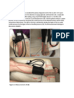 Rumus Mengukur Ankle Brachial Indeks