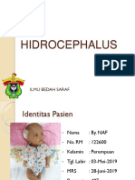 Hidrocefalus Lapsus