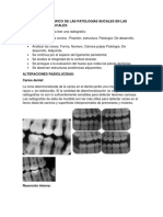 Análisis Radiográfico de Las Patologías Bucales en Las Películas Intrabucales