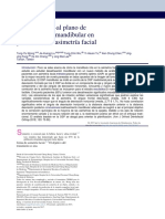 Análisis de Plano A Plano de Asimetria Mandibular. (1) .En - Es