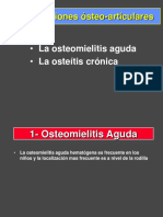 1- Osteomielitis Agudas