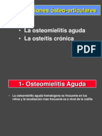 1 - Osteomielitis Agudas