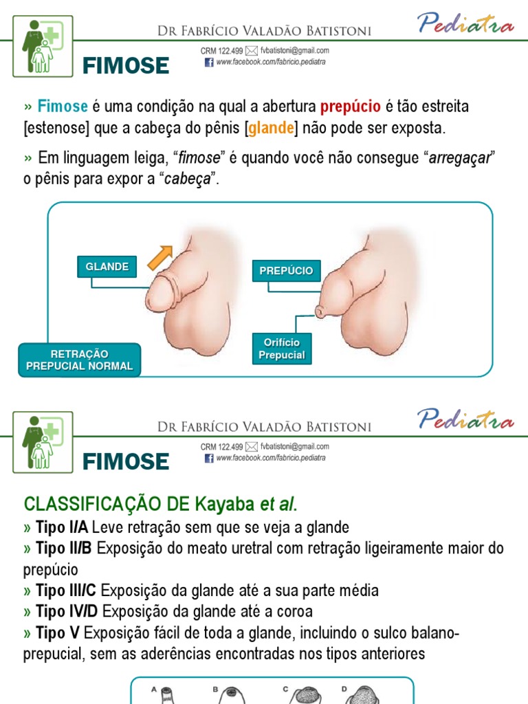 Classificação da Fimose em Graus | PDF | Urologia | Aparelho geniturinário