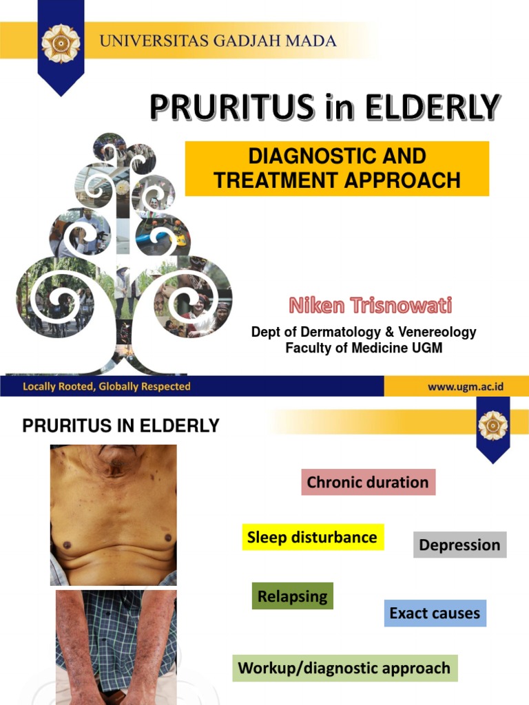 Pruritus in Elderly Diagnostic and Treatment Approach PDF PDF