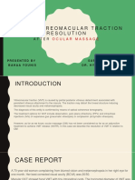 Resolution of Vitreomacular Traction After Ocular Massage