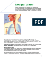 Esophageal Cancer