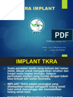 Tkra Implant: Presented By: Kartiwa, S.Kep. Ns