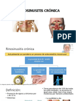 Rinosinusitis Crónica