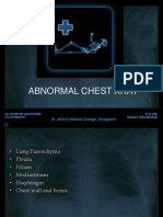 Abnormal Chest X Ray