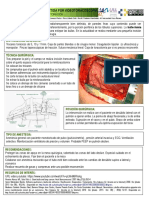 Bullectomia