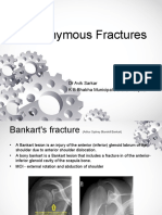 Eponymous Fractures: DR Avik Sarkar K B Bhabha Municipalgeneral Hospital