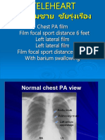 Chest PA Film Film Focal Sport Distance 6 Feet Left Lateral Film Left Lateral Film Film Focal Sport Distance 6 Feet With Barium Swallowing
