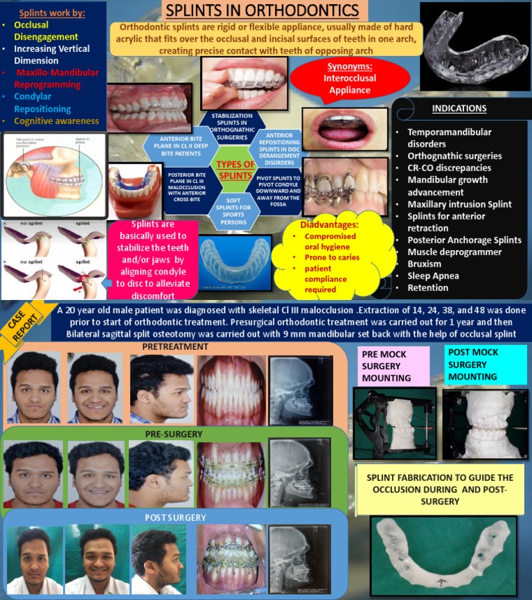 Overview of Orthodontic Splints | PDF | Orthodontics | Dentistry