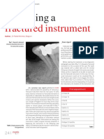 Fractured Instrument: Bypassing A
