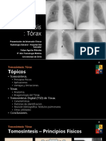 Tomosíntesis de Tórax: Principios, Aplicaciones y Ventajas en Detección de Nódulos Pulmonares