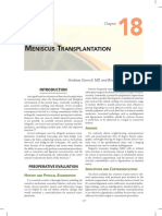 Review Meniscus Transplantation