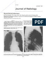 The British Journal of Radiology: Round (Helical) Atelectasis