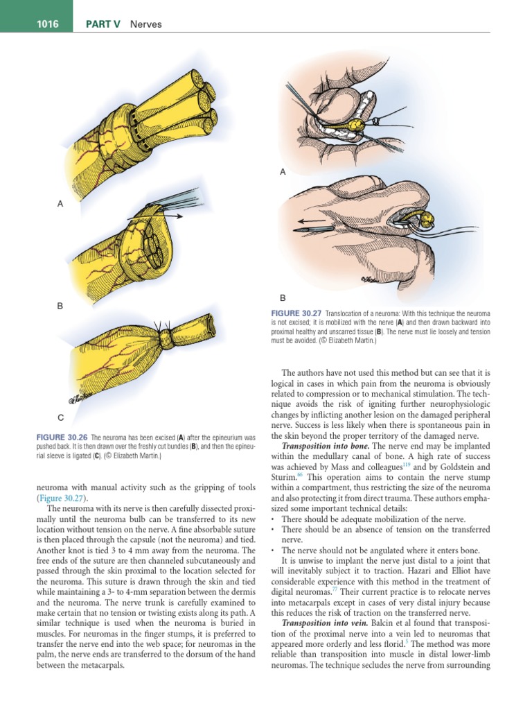 健康・医学 Green's operative hand 7th edition Green's Operative Hand Surgery, 2-Volume Set: 9781455774272