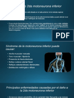 Sindrome 2 motoneurona