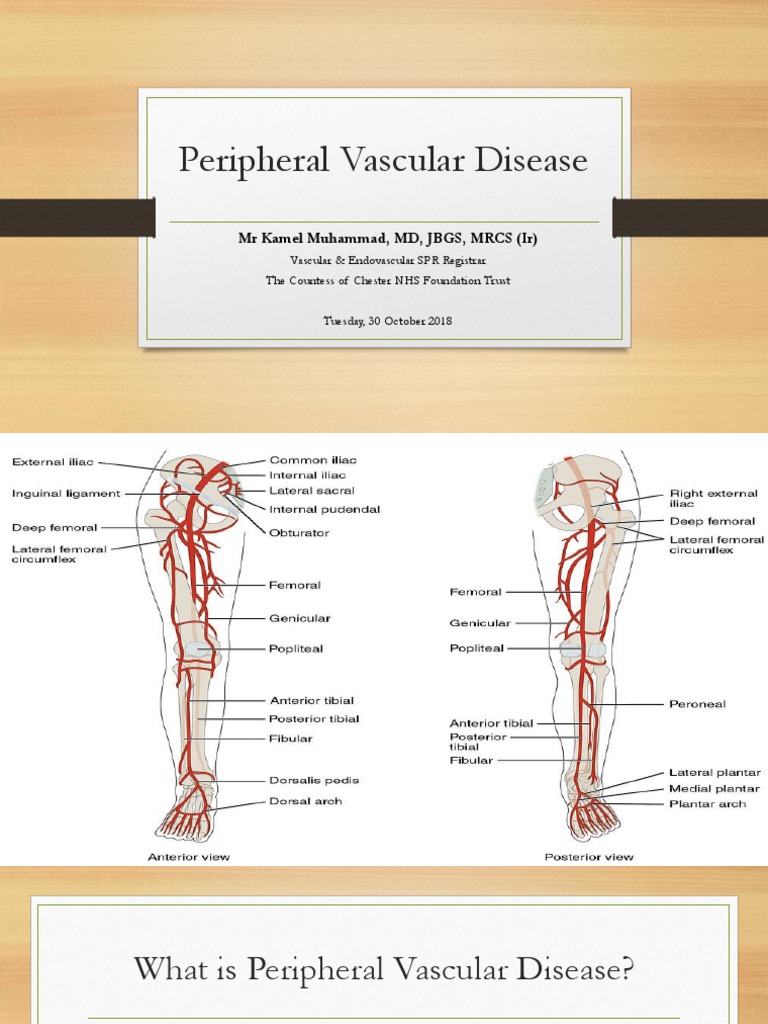 Understanding Peripheral Vascular Disease | PDF | Cardiovascular ...
