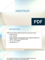 Arritmias