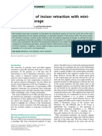 Biomechanics of Incisor Retraction With Mini-Implant Anchorage