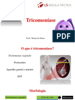 Tricomoníase