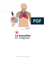 Hemofilia.pdf