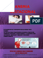 Anemia Gestacional