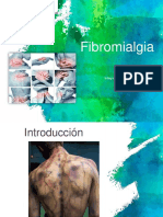 Fibromialgia 