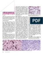 WHO Classification of Tumours of The Central Nervous